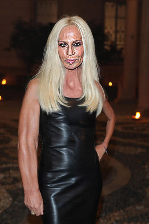 donatella versace surgery. Donatella Versace is really